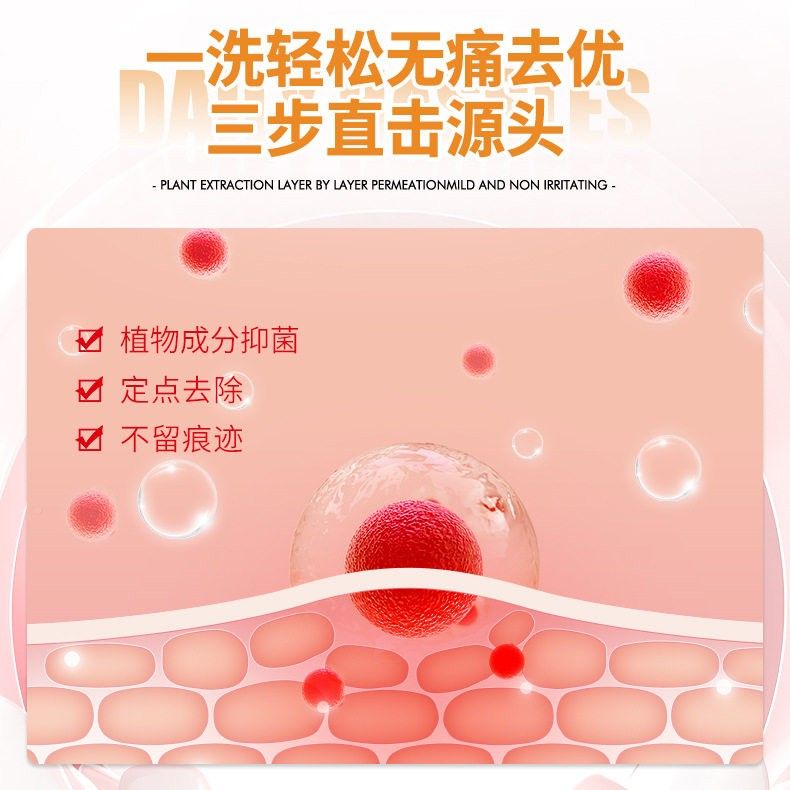 香汉方大药房港润安瘊尤皂尤子皮肤SAN凸起颗粒脱猴落养护止痒邹