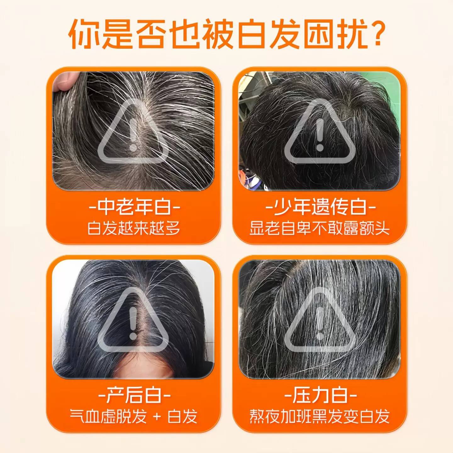 康严维素生素b发毛生物男LZL女内调白发掉滋养囊黑发固发改善发质