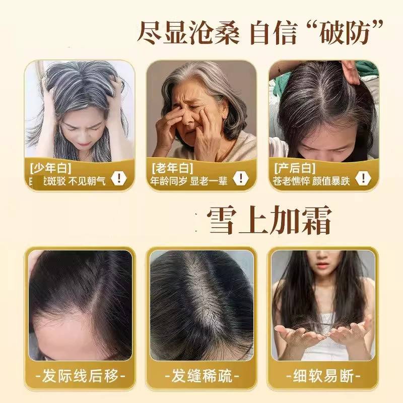 沃RYE普希维素b片官方正品旗发店维生d3黑少中生老年舰鸟素m1