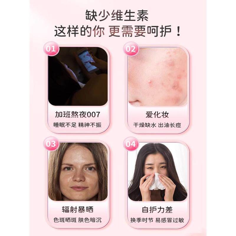 烟胺酰维生素c口服维c维e组vcv官e维生素合e咀TIU嚼片正品方男女