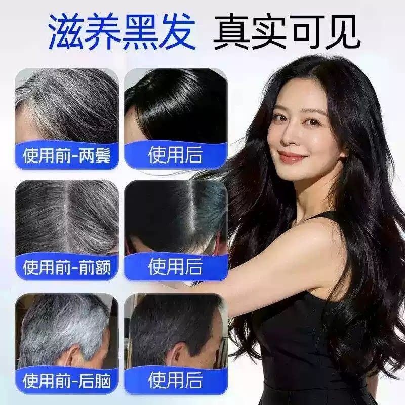 必克邦维生素种b维多素FCB多维生矿物质复合维生素素中老年官方正