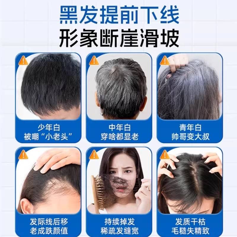 维安生素QJZd3同维微安维维复合维生素发素黑乌发非进正口品旗舰
