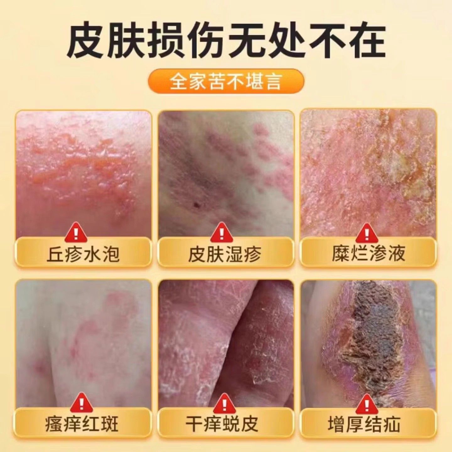 皮舒宁囊皮肤红肿胶痒FIL干燥皮 皮舒宁脱呵健护肌肤康正品