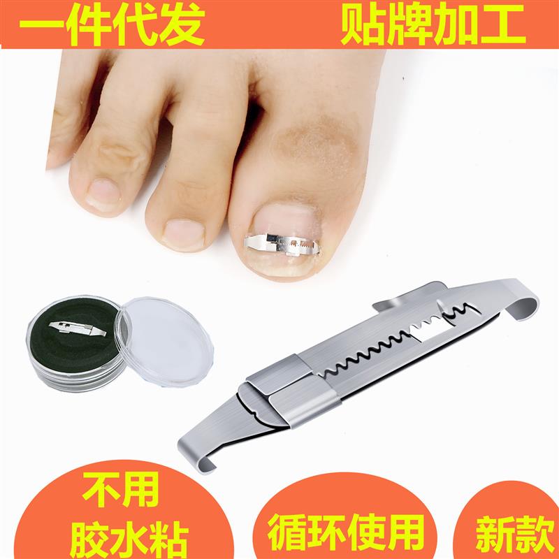 嵌甲 正甲扣 正甲贴 卷甲矫嵌甲正器脚趾甲拉拉贴刀钳
