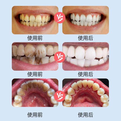 Japanese-style teeth cleaning cloth, a miraculous nano-stain