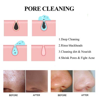 West&Month Blackhead Cleansing Clay Mask - Fades Acne Marks,