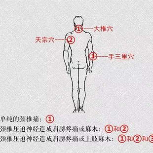 安和牌颈椎贴安通舒贴肩痛膏疏通消除理疗手臂肩腿酸胀困麻