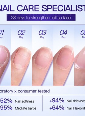 NewToenail Nail Fungus Treatment Repair Fingernail Device To