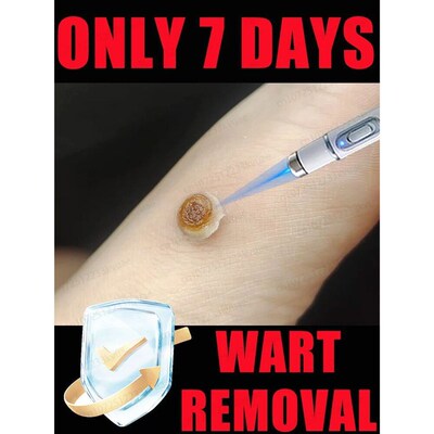 Generaton-2 Laser Says Goodbye To all warts n 7 Days