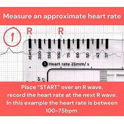 ECG 7 Step Ruler Portable ECG Guide Measurement Tool