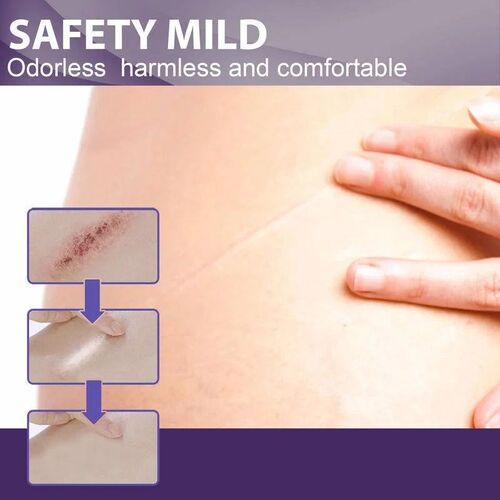 8pcs Silicone Scar Sheets Painless Repair Tape Scar Removal