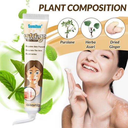 Eliminate Skin Vitiligo Cream Remove Ringworm White Spot