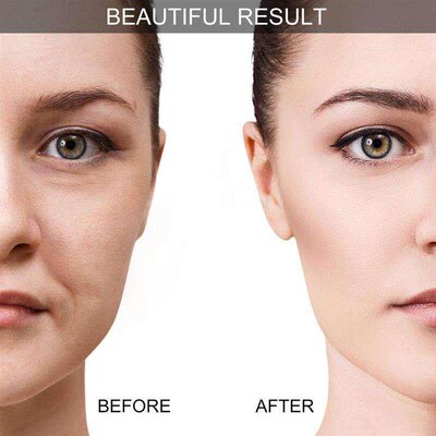 7Pcs Cupping Facial Set for Face Eye Cupping Massage,Facial