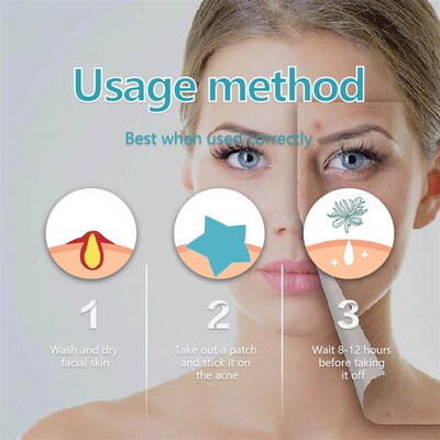 West&Month Hydrocolloid Acne Patches for Pimple and Blackhea