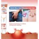 Ointment Eczema Remove Odor itch Antibacterial Anti Cream