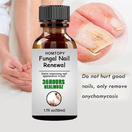 Nail Essence Onychomycosis Repair Antibacterial Gray Nail