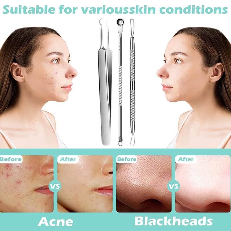 Blackhead Remover Tools Pimple Popper Tool Kit Acne图片