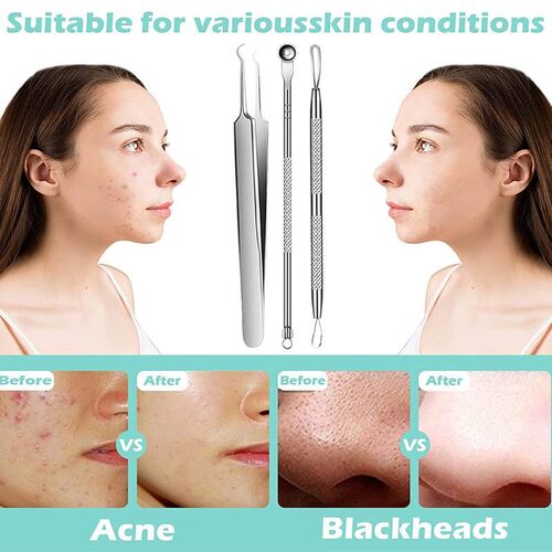 Blackhead Remover Tools Pimple Popper Tool Kit Acne
