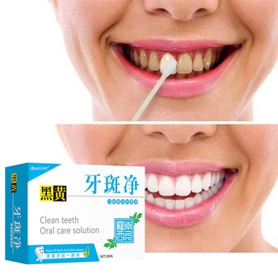 Teeth Whitening Serum Cleans Mouth Freshens Breath Essence