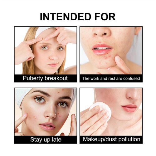 Hoygi Cute Black Acne Patch - Reduces spots, blackheads, and