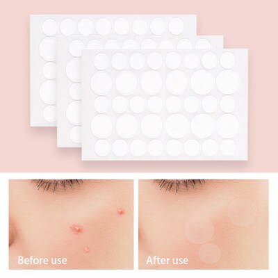 24/36 Dots Acne Patches Sheets Pimple Healing Patch Invisibl