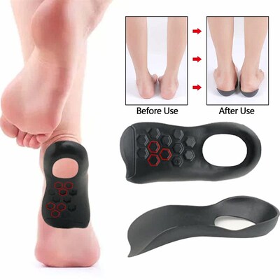1 Pair Arch XO Leg Orthotics Shoe Pads Support Insoles Feet