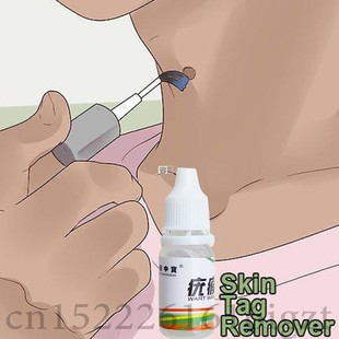 Skin Tag Mole Wart Remover Eye Skin Tag Remover 12 Hours