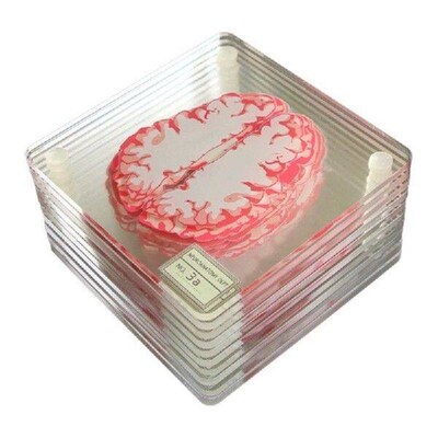 Brain Specimen Coasters Set 3D Organ Brain Artwork Brain
