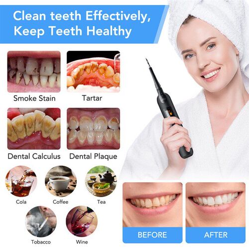 Plaque Remover for Teeth Electric Tooth Cleaner牙洁器洁牙仪