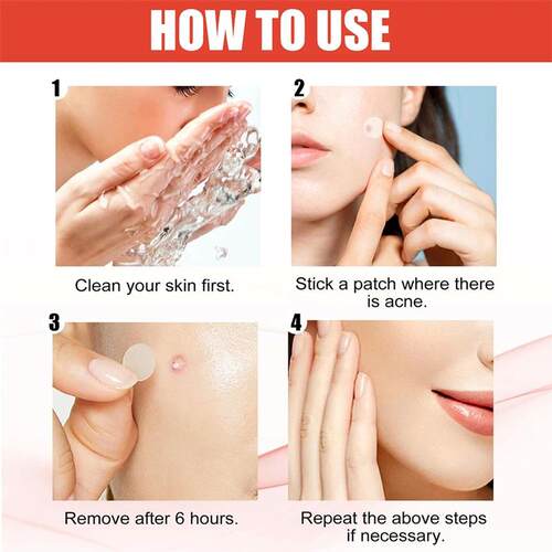 144pcs/set Face Skin Care Acne Pimple Patch 2 Sizes Invisibl