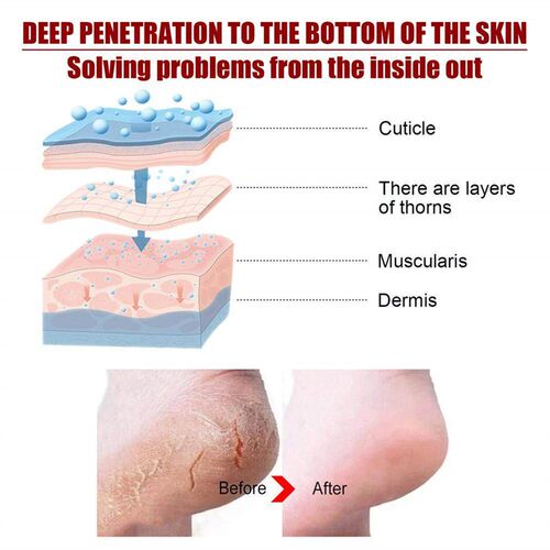 1Pair Exfoliating Foot Mask Film Exfoliation Scrub Remove De