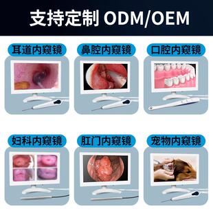 高10M10耳鼻内喉寸检窥镜查清仪1000万高清像素支持摄像头
