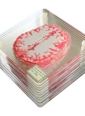 Brain Specimen Coasters Set 3D Organ Brain Artwork Brain
