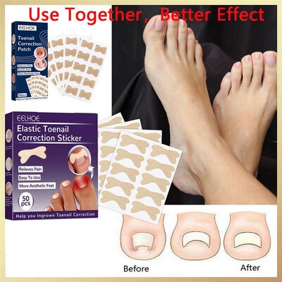 50pcs Nail Correction Stickers Ingrown Toenail Corrector Pat