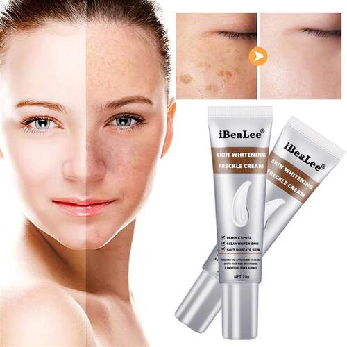 Whitening Freckle Cream Remove Melasma Cream Remove Dark Spo