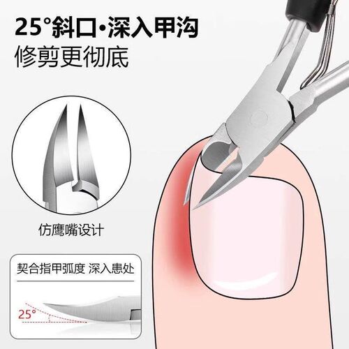 Nail Clippers Eagle Beak Pliers Special for Ingrown Toenails