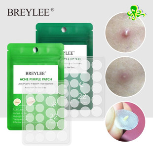 Remover Acne Treatment Stickers Pimple Patch