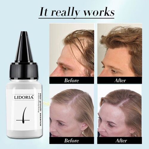 护发生长For Men Fast Hair Growth Essence Oil Hair Loss
