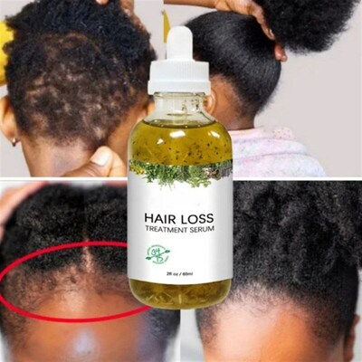 Scalp Hair Oil Tonic Essence Hair Growth Massag 头发增长油