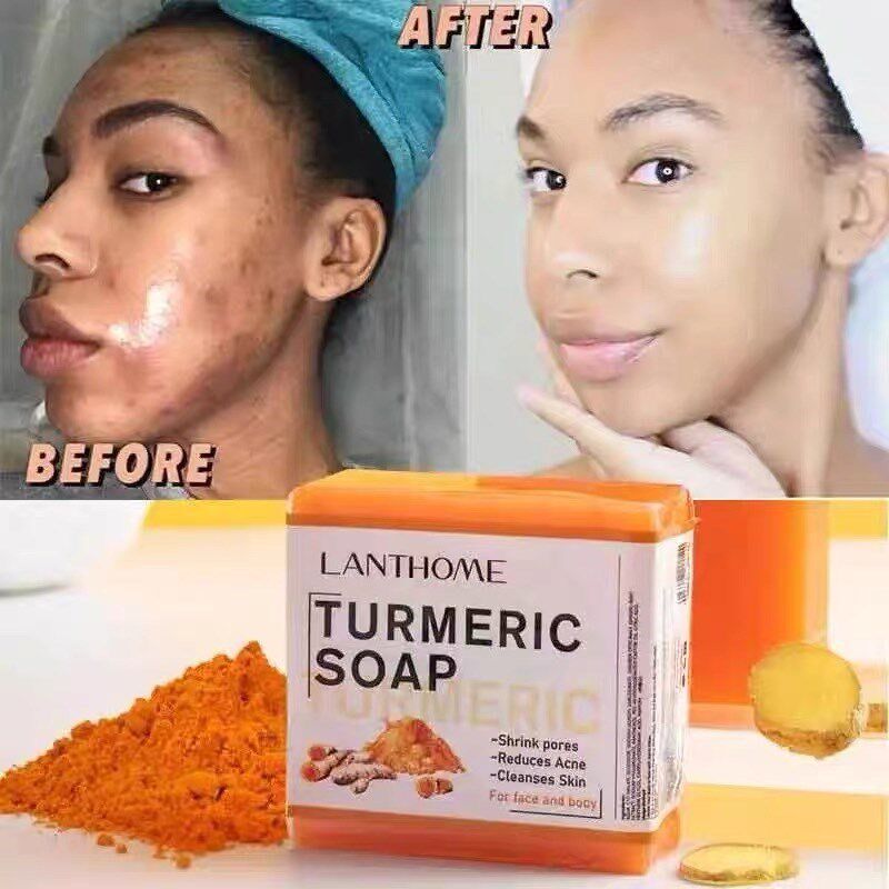 姜黄皂 TURMERIC SOAP Remove Pimples Dark Spots 新品 Turmeric - 实物图