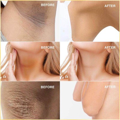Kojic Acid Soap Handmade Whitening Skin Lightening Whitening