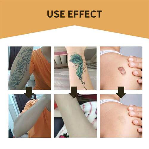Tattoo Concealer Sticker Scar Cover Concealing Corrector Wat