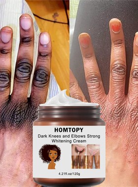 Dark Knees and Elbows Strong Whitening Cream