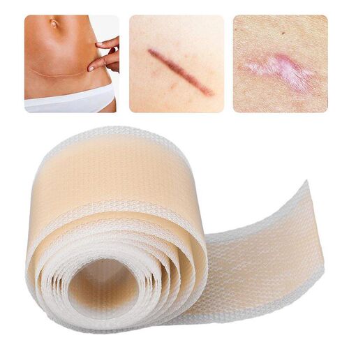 Scar Sheet Scar Silicone Strip Scar Tape Roll