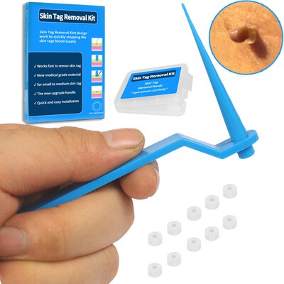 1 Set Skin Tag Kill Skin Mole Wart Remover Micro Skin Tag Re