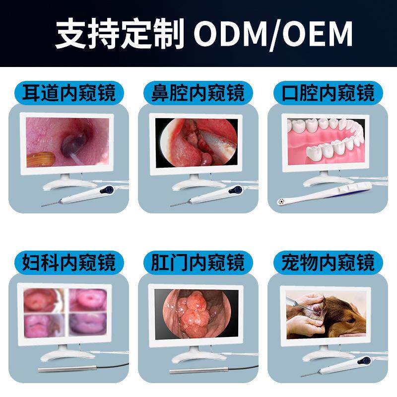 高清10寸耳鼻喉检M10像内窥查1仪000万高清像素支持镜摄头