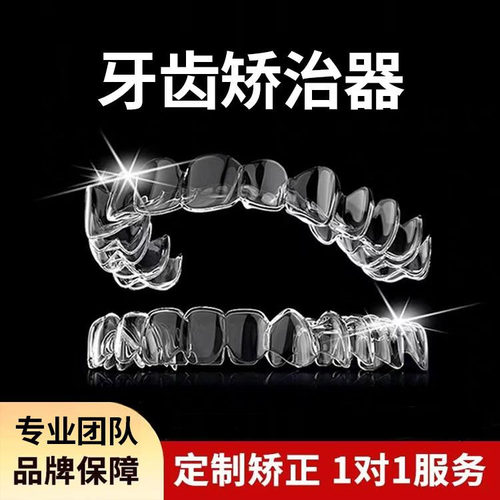 成人牙齿矫正器定制牙套隐形正畸