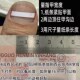 镍钛加宽扁条正甲贴扁钢丝贴矫正卷甲修脚趾甲痛专用炎甲沟刀