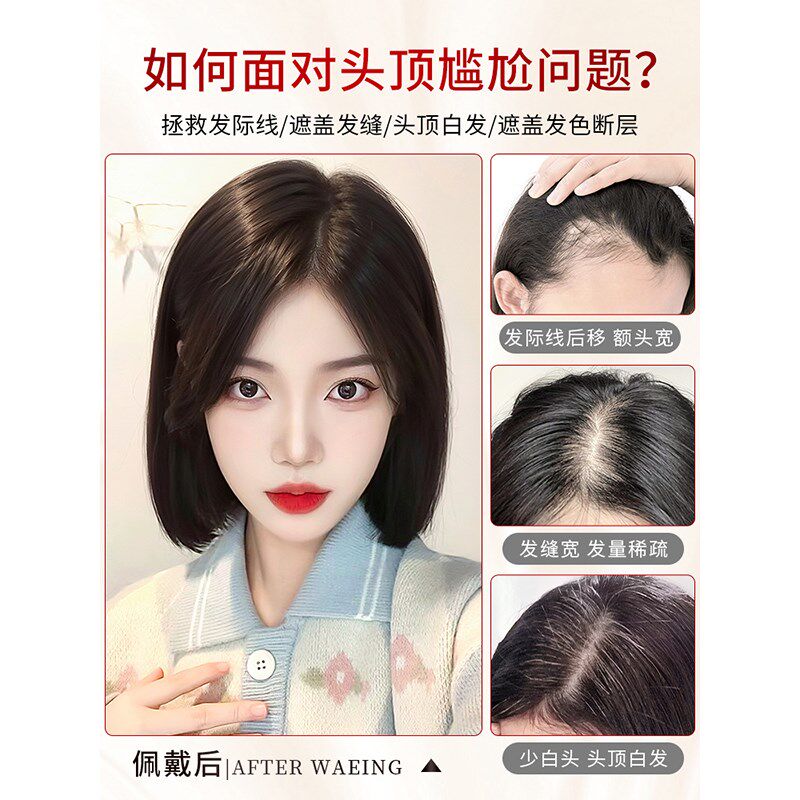 递针假发女片头顶全真发自然前额蓬松遮白发增发量轻薄无痕补发片