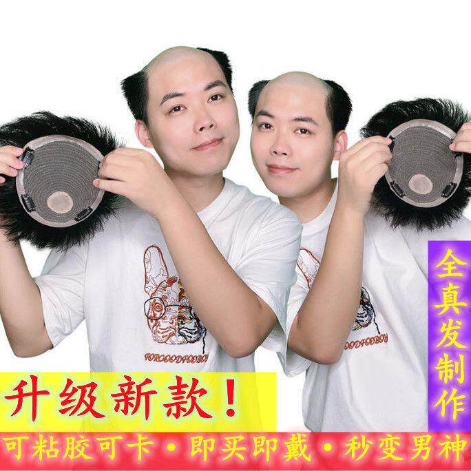 假发男真发补发片新款头顶地中海短发黏贴爸爸假发片中老年可水洗